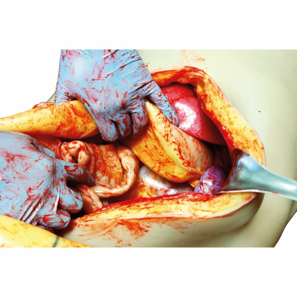 OS3 STOPS Medical – Système de Simulation Chirurgicale Ouverte Haute Fidélité